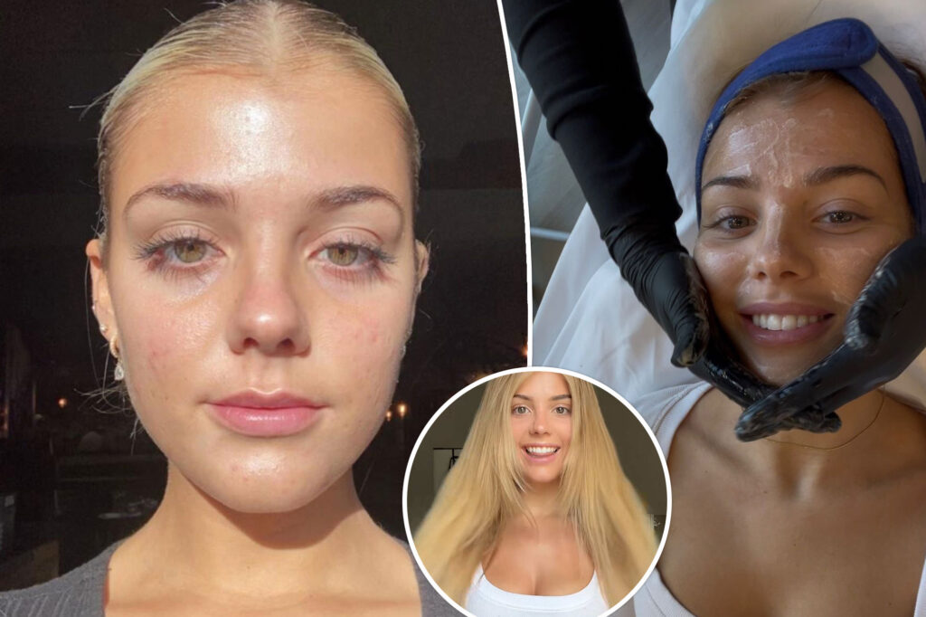 I used Chatgpt to start my glow - saved me thousands of dollars and I'm hotter than ever